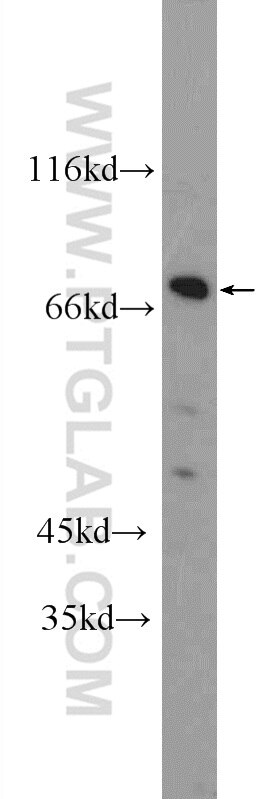 Western Blot (WB) analysis of MCF-7 cells using ZNF326 Polyclonal antibody (25147-1-AP)