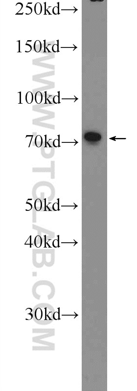 Western Blot (WB) analysis of PC-3 cells using ZNF326 Polyclonal antibody (25147-1-AP)