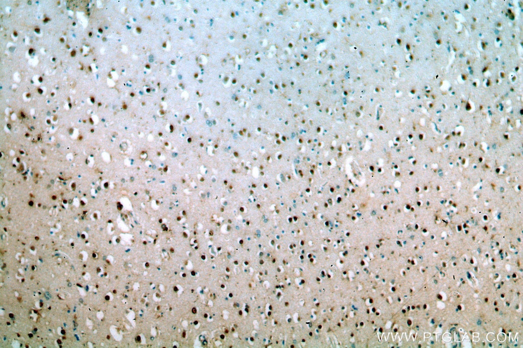 Immunohistochemistry (IHC) staining of human brain tissue using ZNF34 Polyclonal antibody (20477-1-AP)