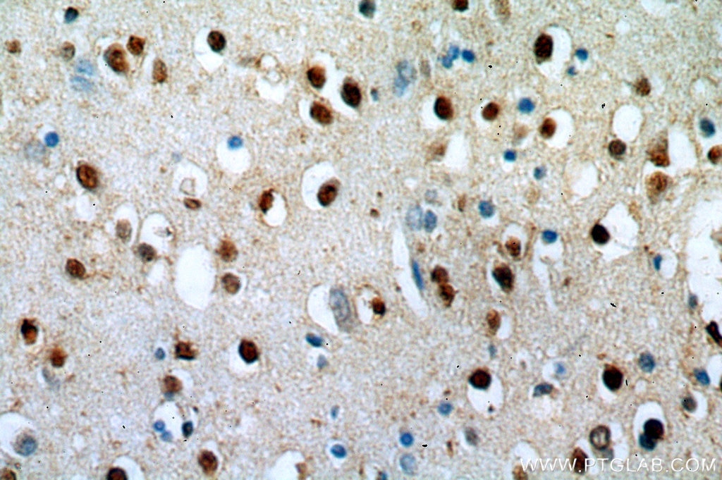IHC staining of human brain using 20477-1-AP