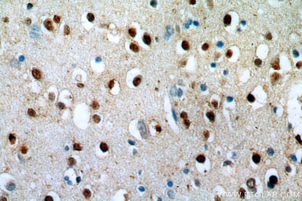 Immunohistochemistry (IHC) staining of human brain tissue using ZNF34 Polyclonal antibody (20477-1-AP)