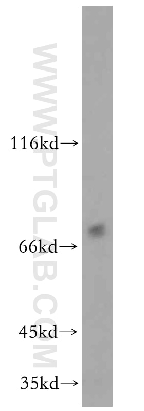 Western Blot (WB) analysis of HepG2 cells using ZNF34 Polyclonal antibody (20477-1-AP)
