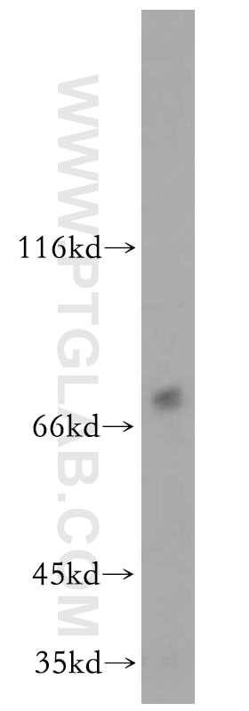 WB analysis of HepG2 using 20477-1-AP