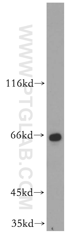 Western Blot (WB) analysis of HeLa cells using ZNF34 Polyclonal antibody (20477-1-AP)