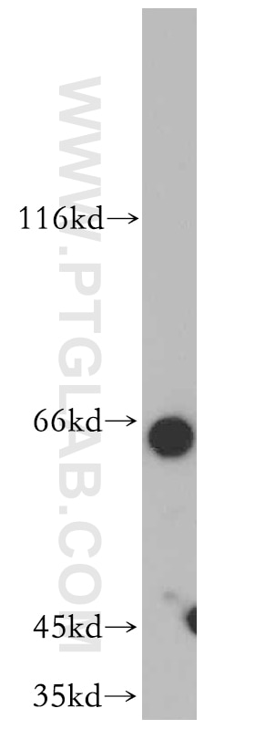 Western Blot (WB) analysis of Jurkat cells using ZNF34 Polyclonal antibody (20477-1-AP)