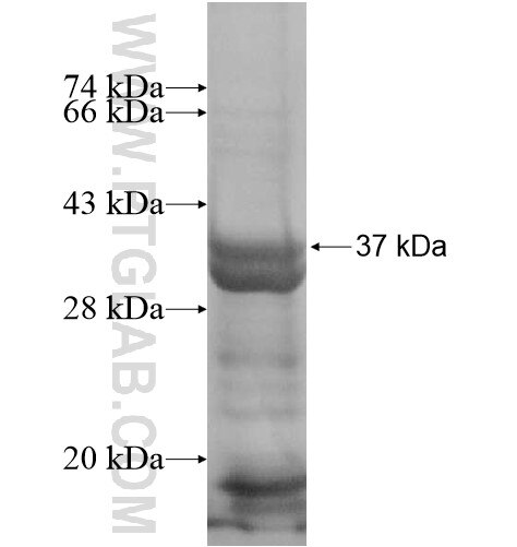 ZNF34 fusion protein Ag15011 SDS-PAGE