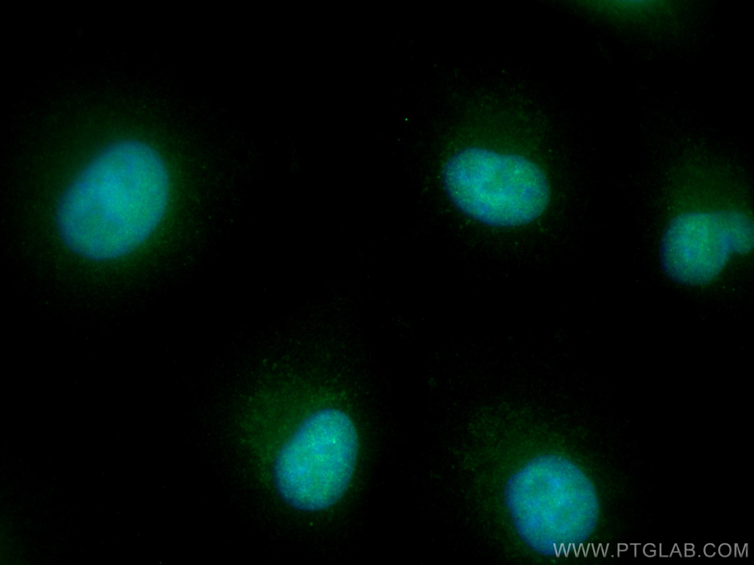 Immunofluorescence (IF) / fluorescent staining of A549 cells using ZNF346 Polyclonal antibody (20794-1-AP)