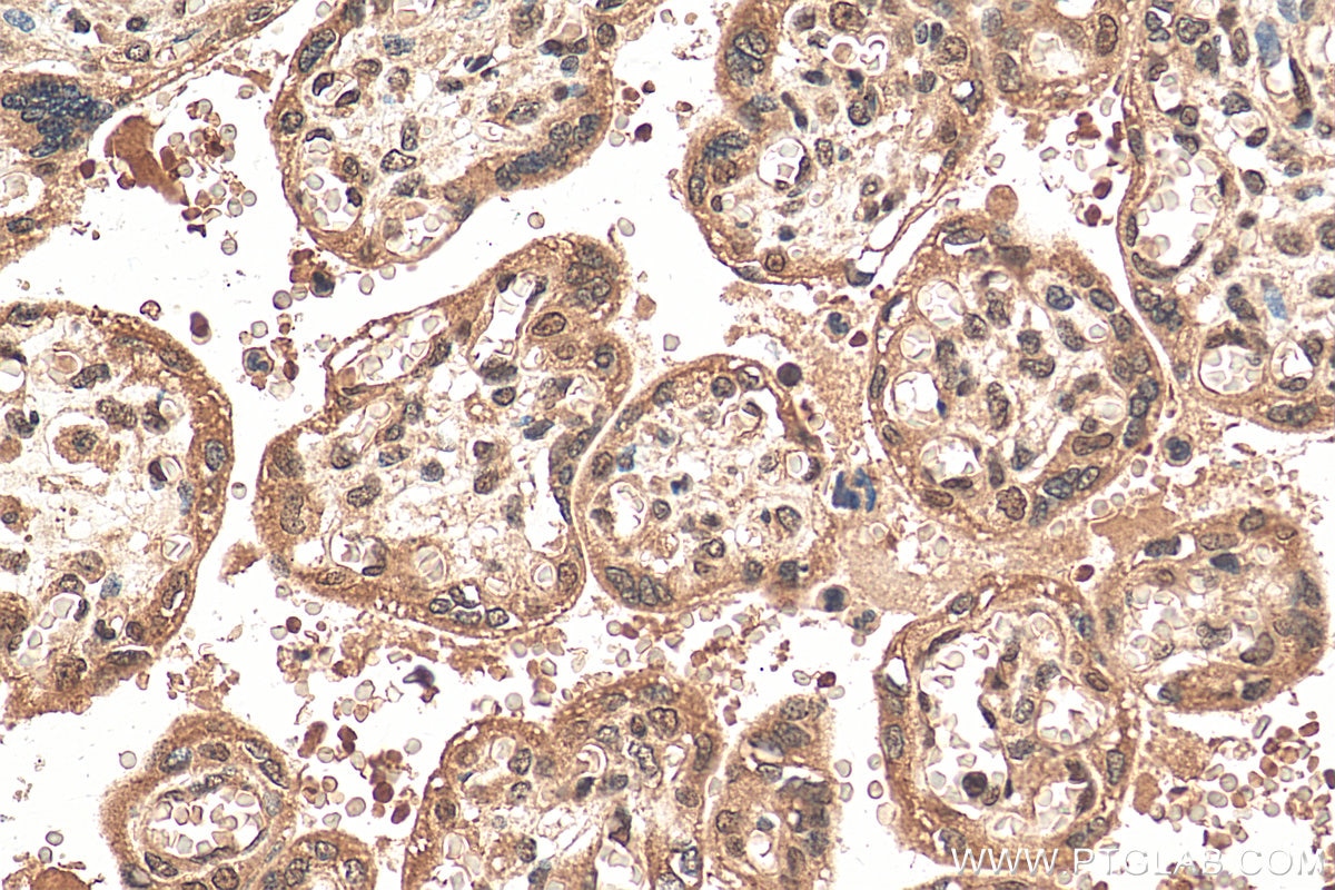 Immunohistochemistry (IHC) staining of human placenta tissue using ZNF346 Polyclonal antibody (20794-1-AP)