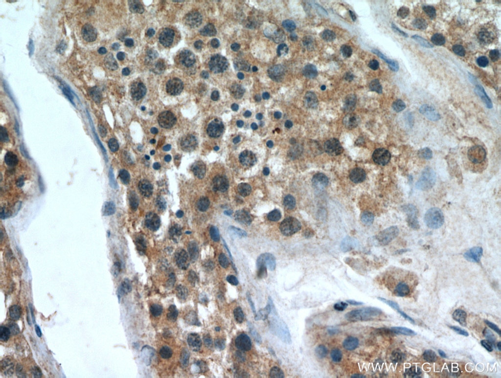Immunohistochemistry (IHC) staining of human testis tissue using ZNF346 Polyclonal antibody (20794-1-AP)