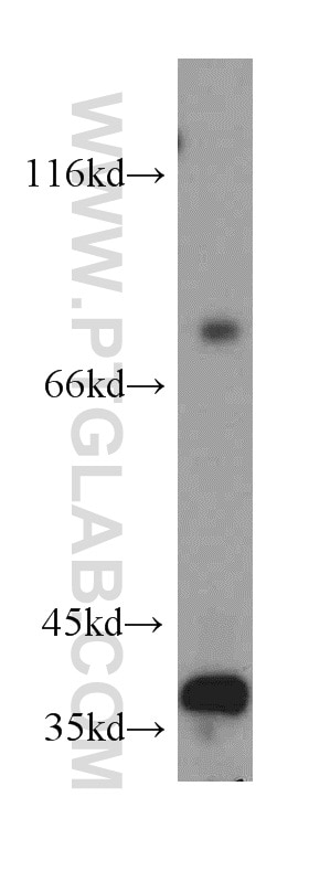 Western Blot (WB) analysis of human brain tissue using ZNF346 Polyclonal antibody (20794-1-AP)