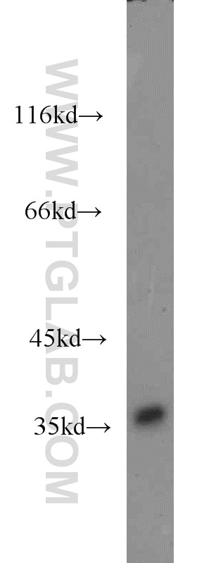 Western Blot (WB) analysis of human brain tissue using ZNF346 Polyclonal antibody (20794-1-AP)