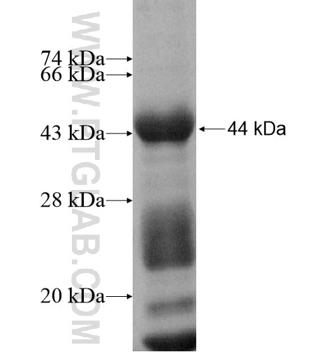 ZNF35 fusion protein Ag10457 SDS-PAGE