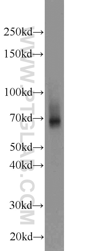 Western Blot (WB) analysis of DU 145 cells using ZNF354A Polyclonal antibody (14072-1-AP)