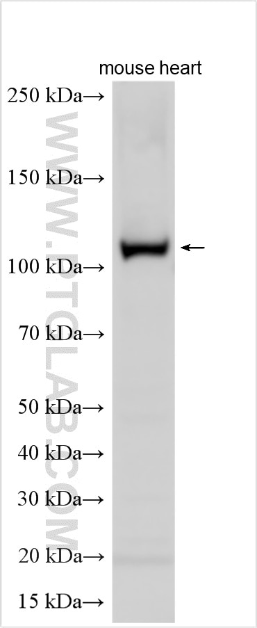 Western Blot (WB) analysis of various lysates using ZNF366 Polyclonal antibody (24340-1-AP)
