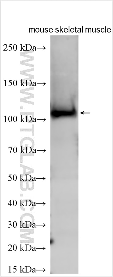 Western Blot (WB) analysis of various lysates using ZNF366 Polyclonal antibody (24340-1-AP)