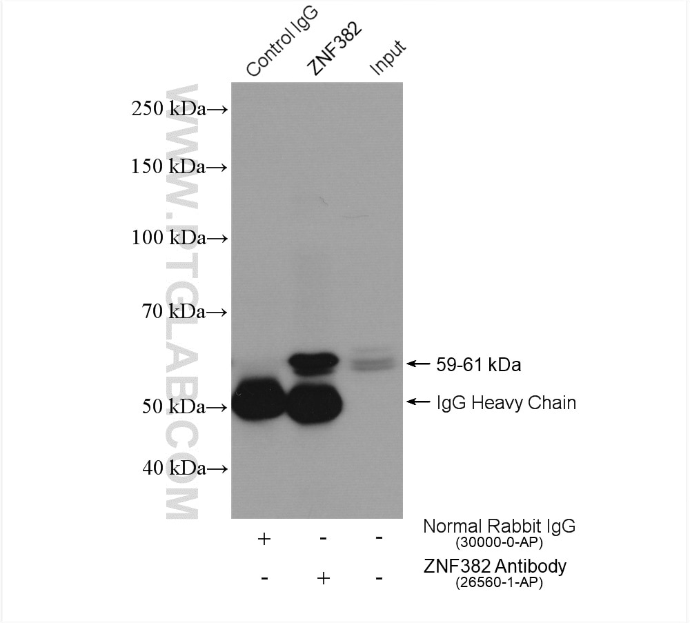 Immunoprecipitation (IP) experiment of SW 1990 cells using ZNF382 Polyclonal antibody (26560-1-AP)