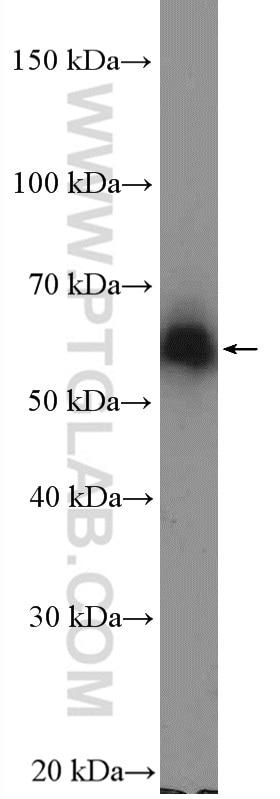 Western Blot (WB) analysis of K-562 cells using ZNF382 Polyclonal antibody (26560-1-AP)
