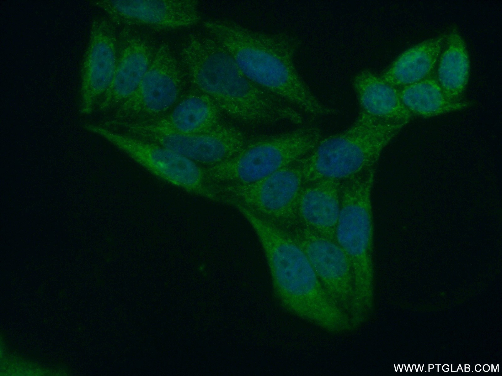 Immunofluorescence (IF) / fluorescent staining of HeLa cells using ZNF385A Polyclonal antibody (26288-1-AP)