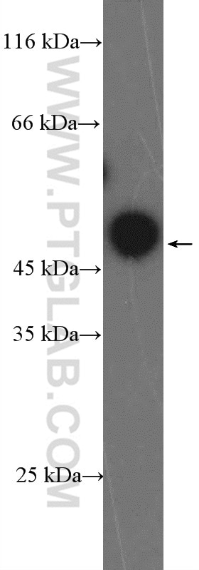 Western Blot (WB) analysis of HeLa cells using ZNF385A Polyclonal antibody (26288-1-AP)