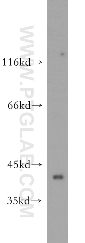 Western Blot (WB) analysis of mouse kidney tissue using ZNF385D Polyclonal antibody (20806-1-AP)