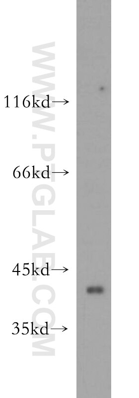 Western Blot (WB) analysis of mouse kidney tissue using ZNF385D Polyclonal antibody (20806-1-AP)