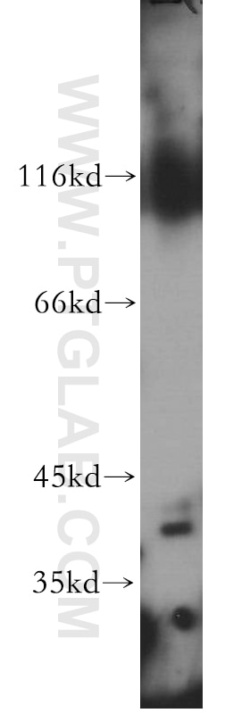 Western Blot (WB) analysis of human testis tissue using ZNF385D Polyclonal antibody (20806-1-AP)