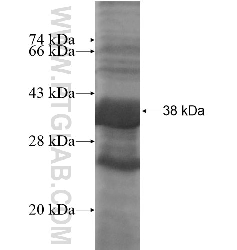 ZNF385D fusion protein Ag14746 SDS-PAGE