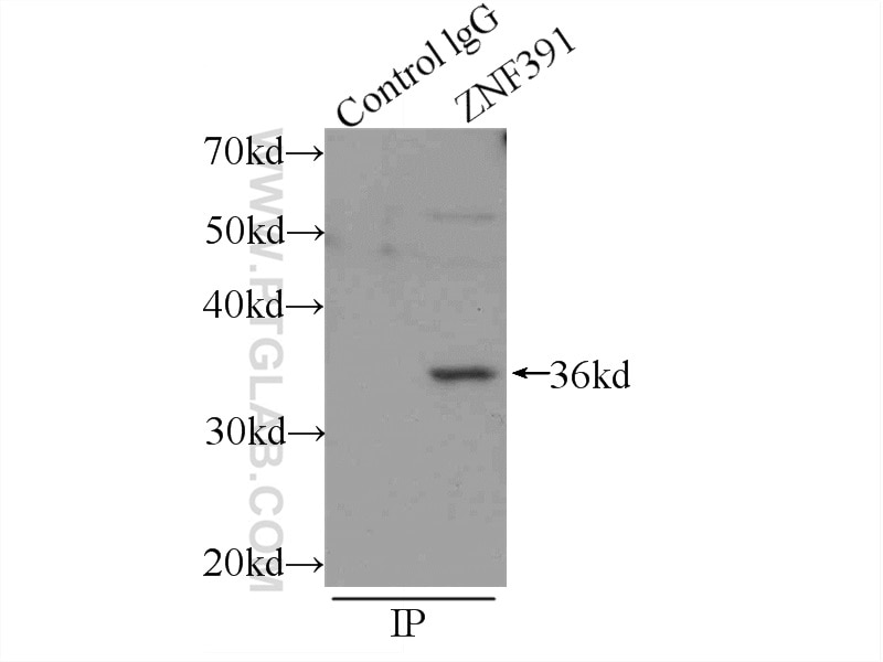 Immunoprecipitation (IP) experiment of mouse testis tissue using ZNF391 Polyclonal antibody (24805-1-AP)