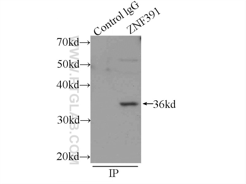 IP experiment of mouse testis using 24805-1-AP