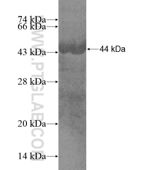 ZNF391 fusion protein Ag20317 SDS-PAGE