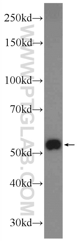 Western Blot (WB) analysis of mouse brain tissue using ZNF394 Polyclonal antibody (25785-1-AP)