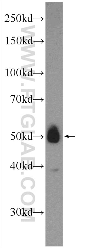 Western Blot (WB) analysis of fetal human brain tissue using ZNF394 Polyclonal antibody (25785-1-AP)