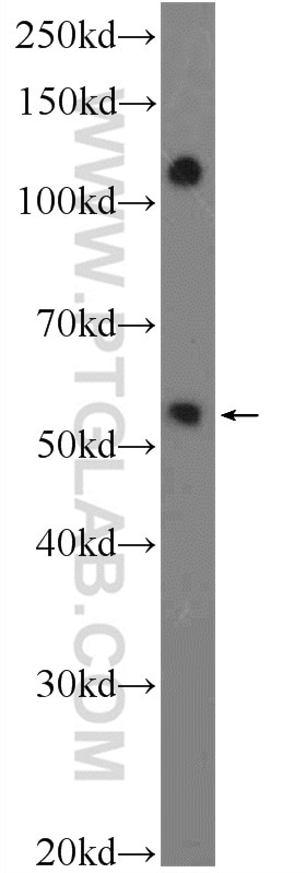 Western Blot (WB) analysis of mouse spleen tissue using ZNF394 Polyclonal antibody (25785-1-AP)