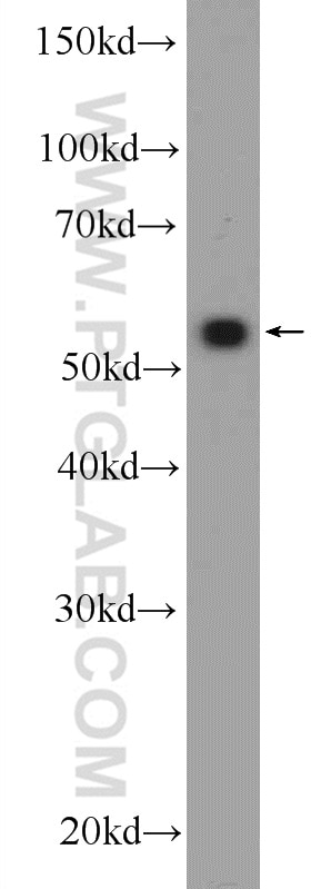 Western Blot (WB) analysis of HepG2 cells using ZNF394 Polyclonal antibody (25785-1-AP)
