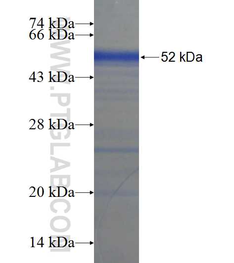 ZNF394 fusion protein Ag22655 SDS-PAGE
