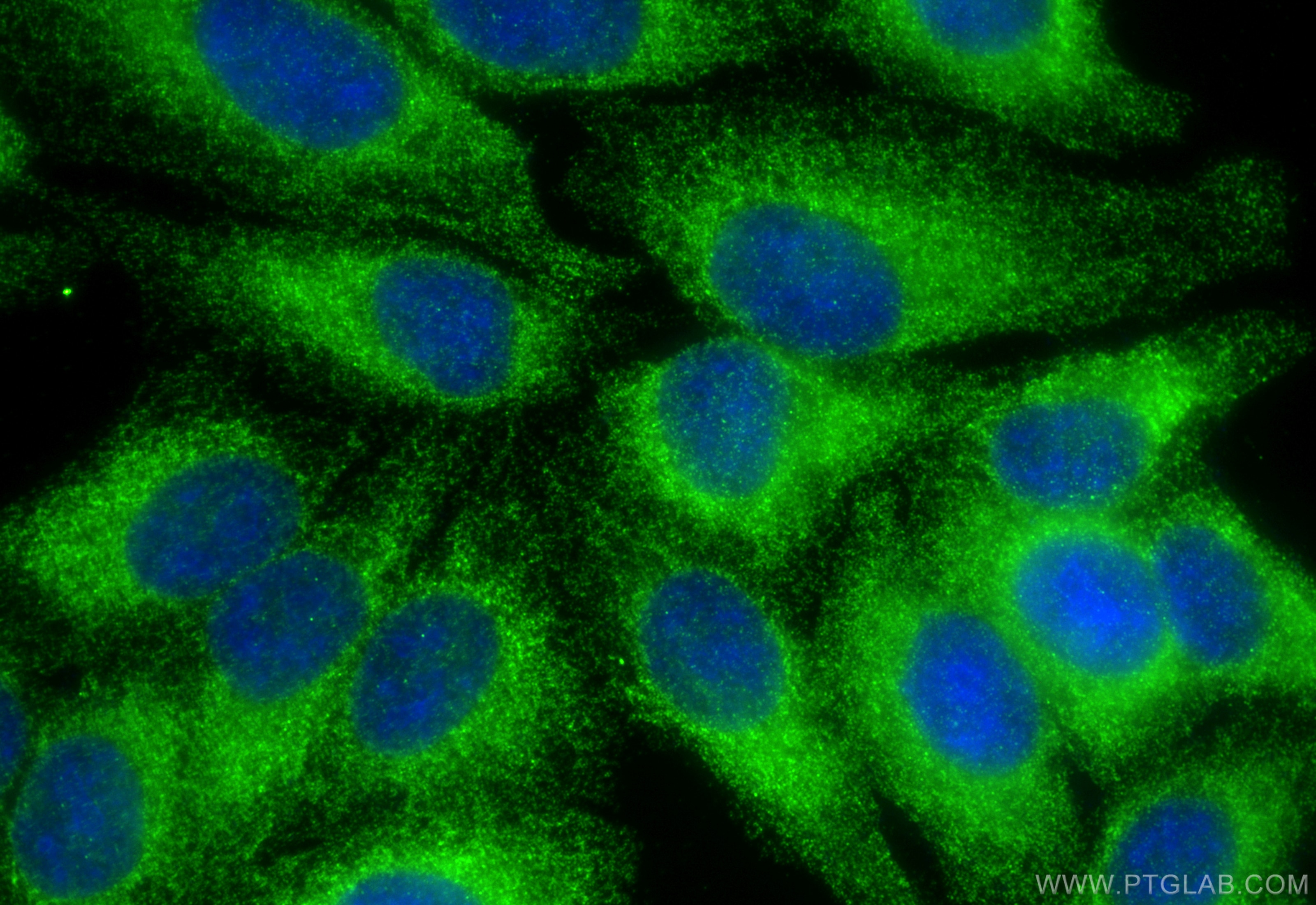 Immunofluorescence (IF) / fluorescent staining of HepG2 cells using ZNF395 Polyclonal antibody (11759-1-AP)