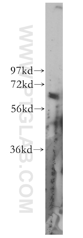 Western Blot (WB) analysis of HeLa cells using ZNF395 Polyclonal antibody (11759-1-AP)