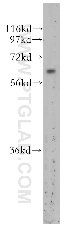 Western Blot (WB) analysis of human brain tissue using ZNF395 Polyclonal antibody (11759-1-AP)