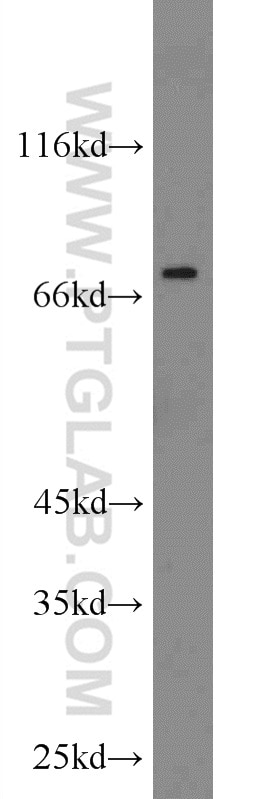 Western Blot (WB) analysis of HepG2 cells using ZNF395 Polyclonal antibody (11759-1-AP)