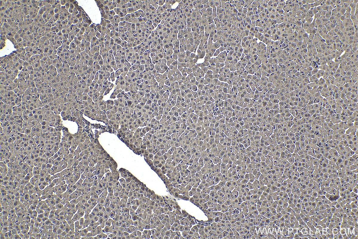 Immunohistochemistry (IHC) staining of mouse liver tissue using ZNF397 Polyclonal antibody (20799-1-AP)