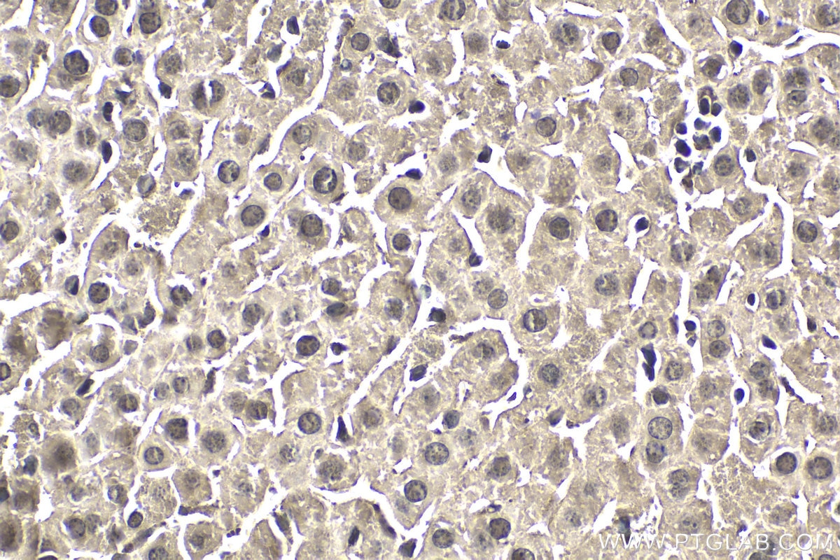 Immunohistochemistry (IHC) staining of mouse liver tissue using ZNF397 Polyclonal antibody (20799-1-AP)