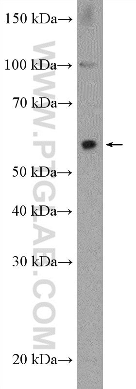 Western Blot (WB) analysis of PC-3 cells using ZNF397 Polyclonal antibody (20799-1-AP)