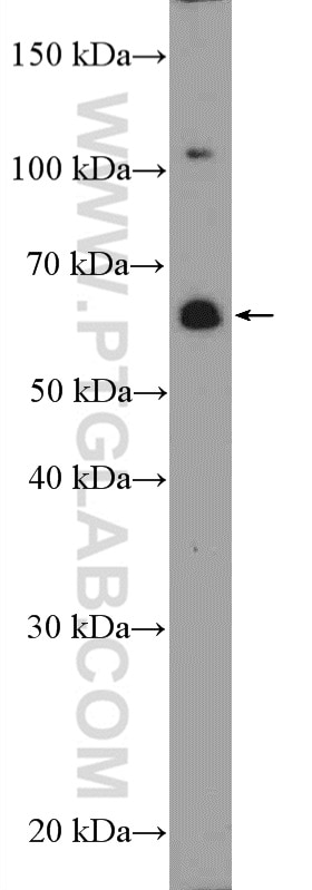 Western Blot (WB) analysis of PC-3 cells using ZNF397 Polyclonal antibody (20799-1-AP)