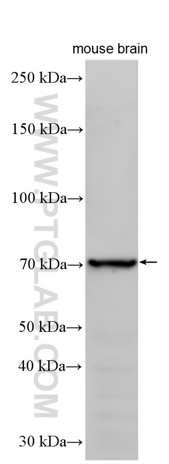 WB analysis using 21592-1-AP (same clone as 21592-1-PBS) Western Blot (WB) analysis of various lysates using ZNF404 Polyclonal antibody (21592-1-AP)