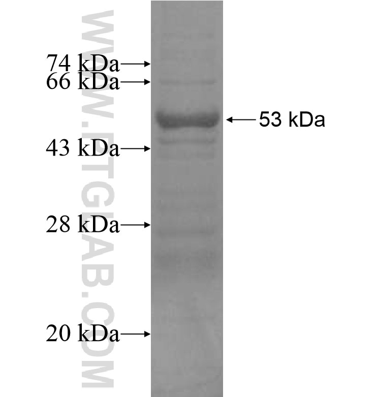 ZNF404 fusion protein Ag16166 SDS-PAGE