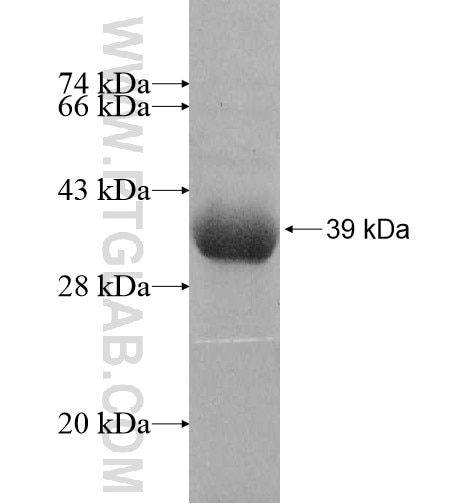 ZNF41 fusion protein Ag11150 SDS-PAGE