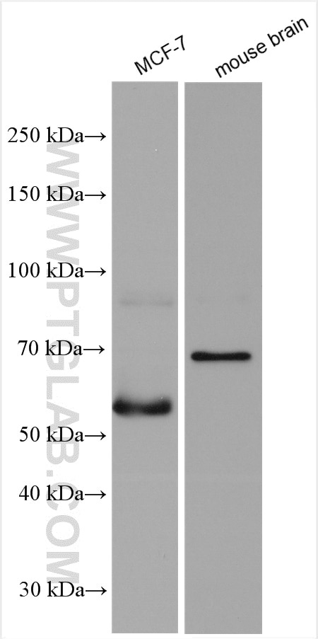 Western Blot (WB) analysis of various lysates using ZNF410 Polyclonal antibody (14529-1-AP)