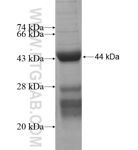ZNF415 fusion protein Ag15604 SDS-PAGE
