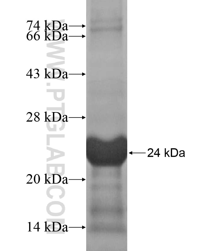 ZNF415 fusion protein Ag17146 SDS-PAGE