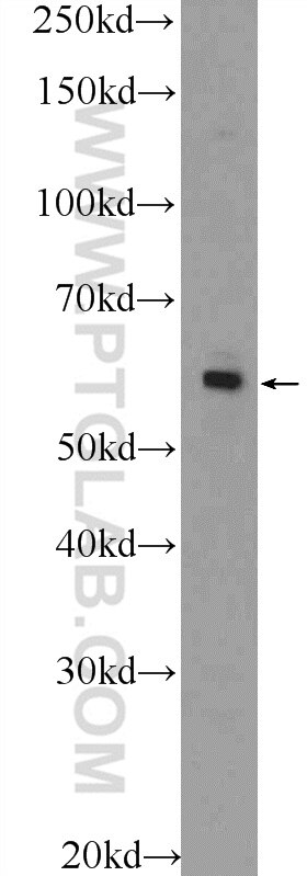 Western Blot (WB) analysis of A549 cells using ZNF419 Polyclonal antibody (25724-1-AP)